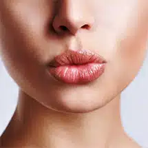 DermaBeauty lips