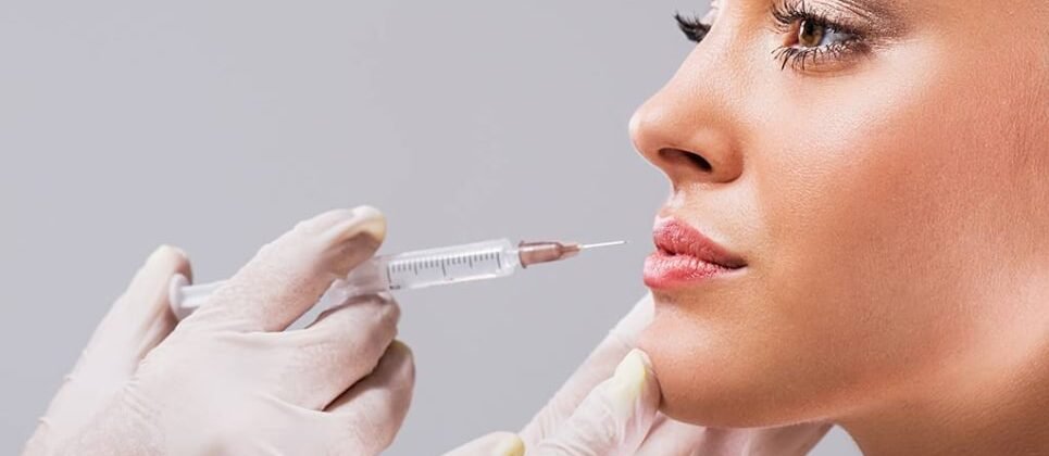 injectare-acid-hialuronic-dermabeauty_2 Volumizare buze cu acid hialuronic