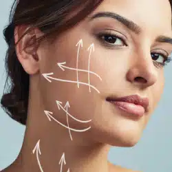 Procedura de Lipofilling Facial
