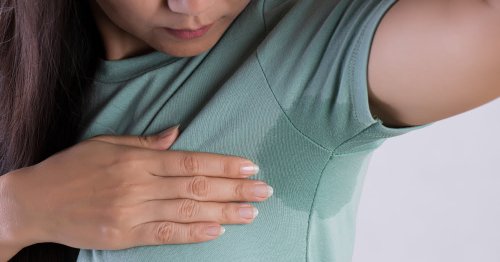 Tratament hiperhidroza