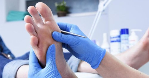 Transpiratia picioarelor