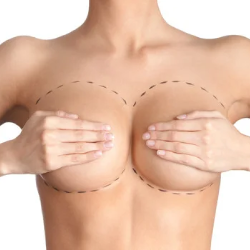 Consultatie implant mamar