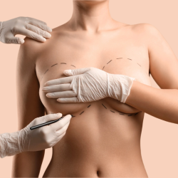 Consultatie implant mamar