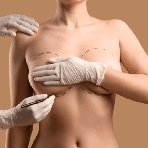 Protejat: Augmentare, Lifting si Reductie mamara