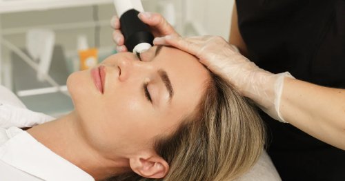 Nu recomandam Laser CO2 vara