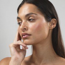 Bichectomie - contur facial definit, DermaBeauty Clinique